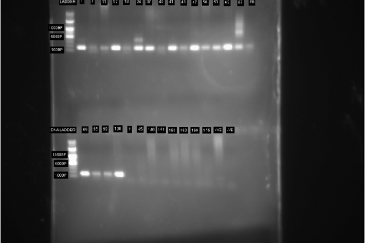 Detection of HPV isolate by Gel electrophoresis using 1.5% Agarose Gel Stained With Ethidium Bromide