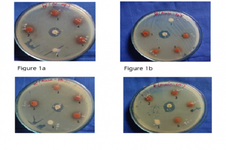 Antibacterial activity of aqueous extract of A.nilotica against P. gingivalis