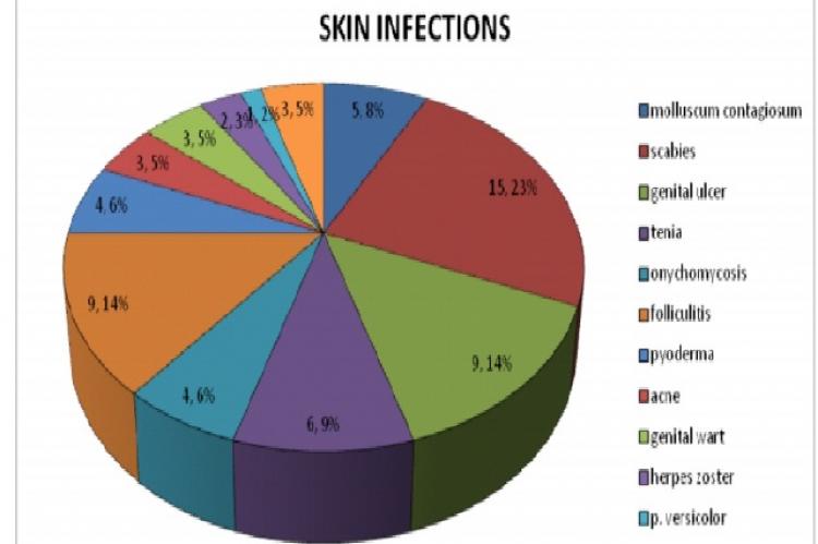 Figure showing the different infective skin conditions in our study