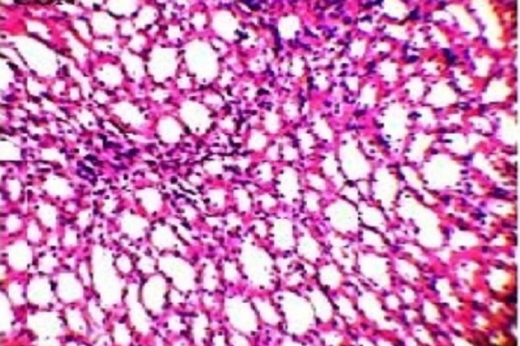 Histological study of kidney tissue in control and experimental groups of rats